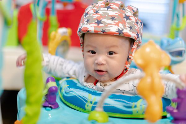 four month old baby wearing helmet